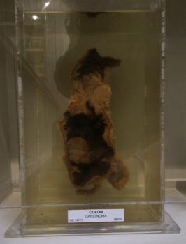 LARGE INTESTINE, colon